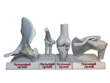 "Суглоби людини , різні типи. Кульшовий, колінний, плечовий, ліктьовий " 1027 фото